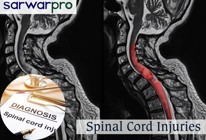 53086spinal-cord-injuries.jpg